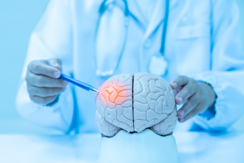 doctor pointing to head injury on brain